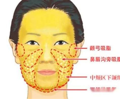 臉頰肉多面相|臉頰肉下垂？看懂脂肪臉怎麼瘦「告別嘴邊肉」－萊茵。